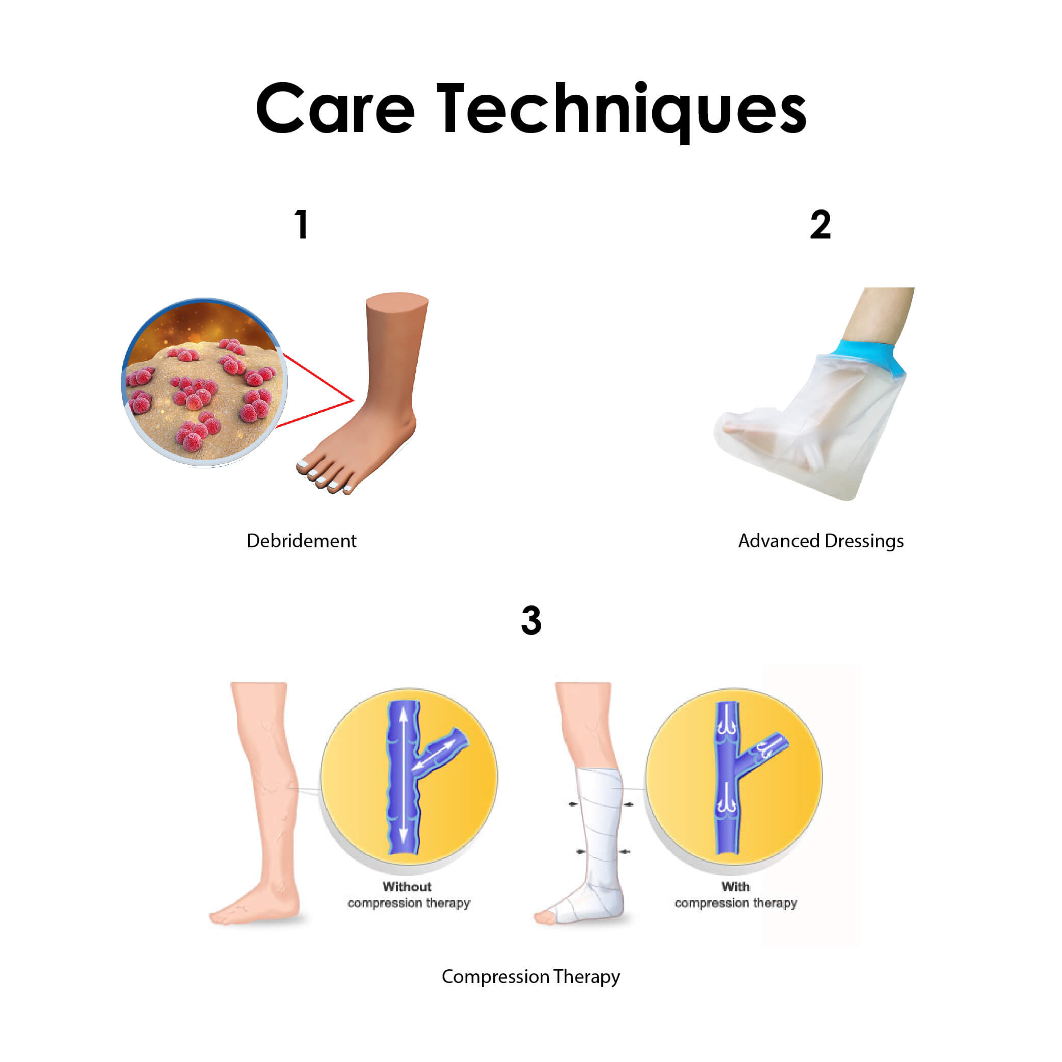 Wound Care Techniques